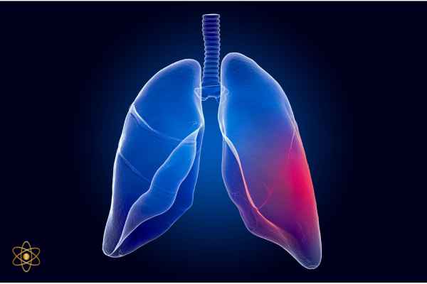 Thymosin Alpha-1 In Treating Cystic Fibrosis