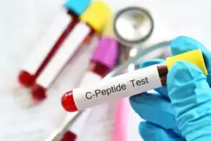 C Peptide Levels